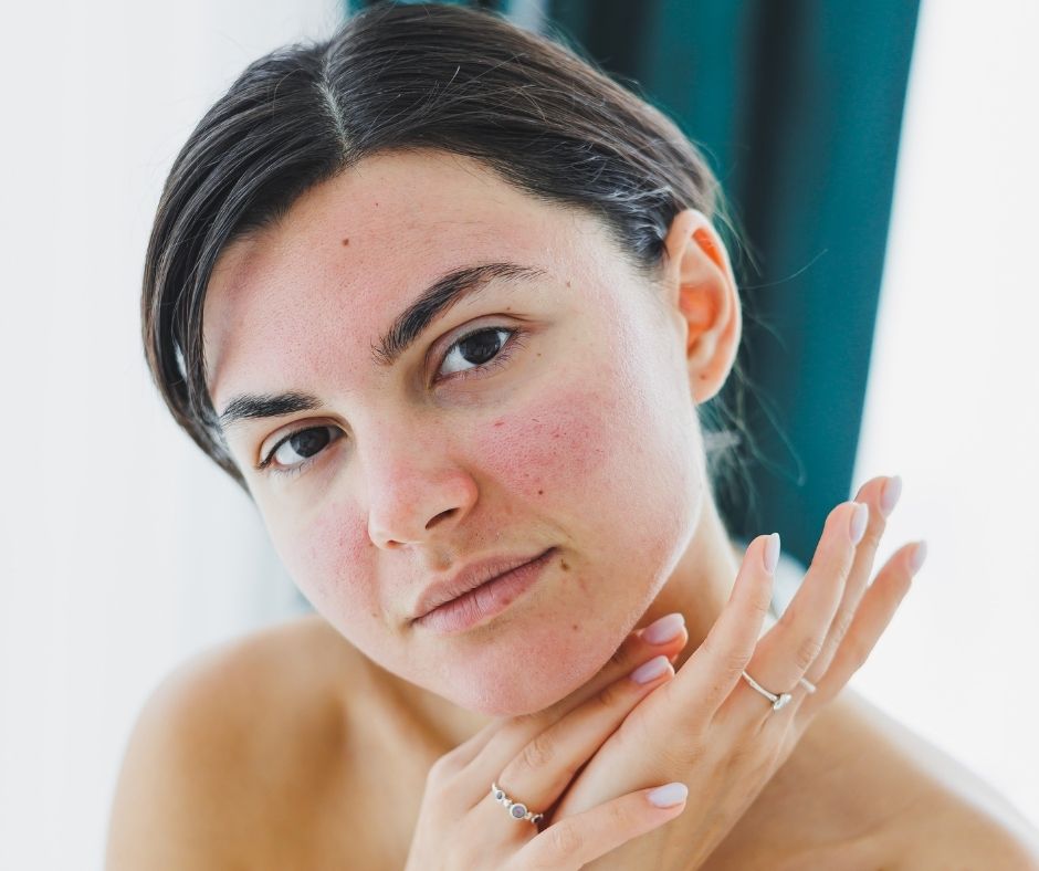 Redness &amp; Reactive Skin